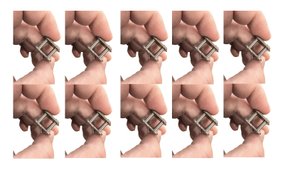 10 unidades de Emenda Simples Simples ASA 40/1 - KIT